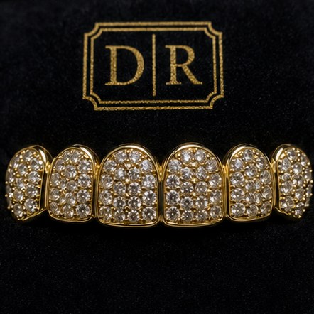 Diamond & Stone-Set Grillz