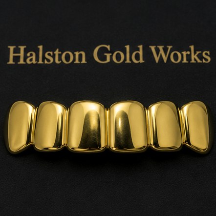 Solid Gold Grillz